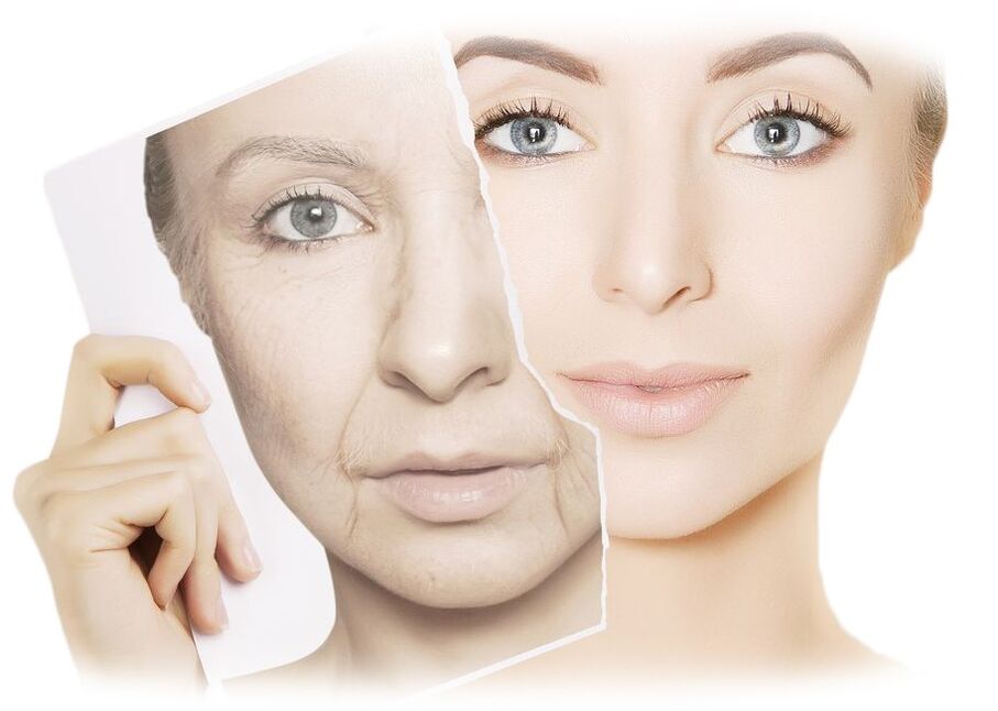 Como funciona a crema intenskin para a rexeneración da pel facial