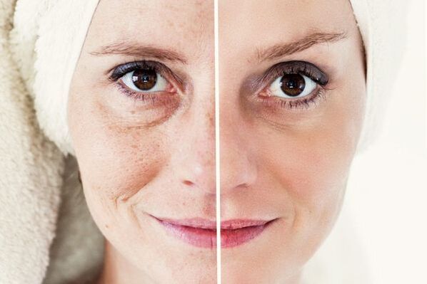 antes e despois