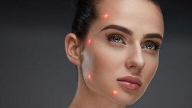 Que é o rexuvenecemento cutáneo fraccionado