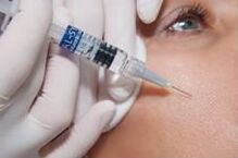 Procedementos de biorevitalización