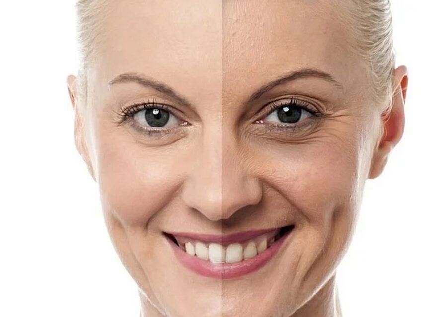 Mellores tratamentos estéticos faciais