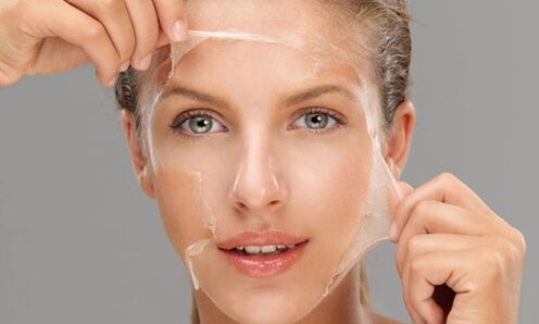 Un peeling profundo favorece os procesos de rexeneración da pel e a rexuvenece